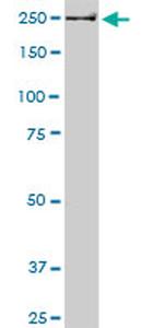 USP9X Antibody in Western Blot (WB)