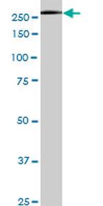 USP9X Antibody in Western Blot (WB)