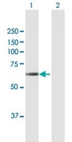 PICALM Antibody in Western Blot (WB)