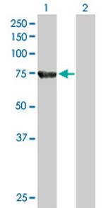 ACOX2 Antibody in Western Blot (WB)