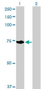 ACOX2 Antibody in Western Blot (WB)