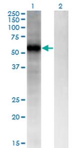 FZD4 Antibody in Western Blot (WB)