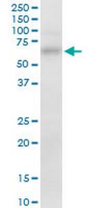 FZD7 Antibody in Western Blot (WB)