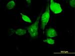 HYAL3 Antibody in Immunocytochemistry (ICC/IF)