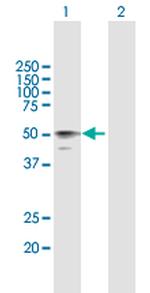 HYAL3 Antibody in Western Blot (WB)