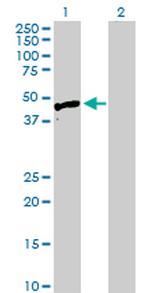 HYAL3 Antibody in Western Blot (WB)