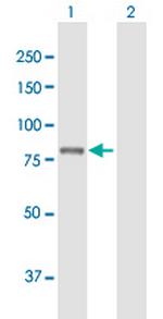 PLA2G6 Antibody in Western Blot (WB)