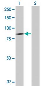 PLA2G6 Antibody in Western Blot (WB)