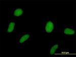 SPOP Antibody in Immunocytochemistry (ICC/IF)