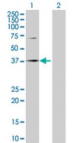 SPOP Antibody in Western Blot (WB)