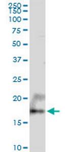 UXT Antibody in Western Blot (WB)