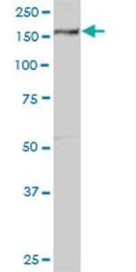 EEA1 Antibody in Western Blot (WB)