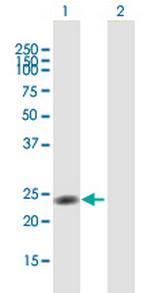 NR0B2 Antibody in Western Blot (WB)