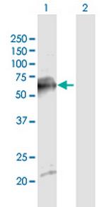 SDPR Antibody in Western Blot (WB)