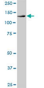 DHX16 Antibody in Western Blot (WB)