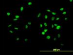 CUL4B Antibody in Immunocytochemistry (ICC/IF)