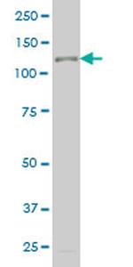 TTF2 Antibody in Western Blot (WB)