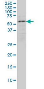 ENC1 Antibody in Western Blot (WB)