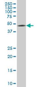 ENC1 Antibody in Western Blot (WB)