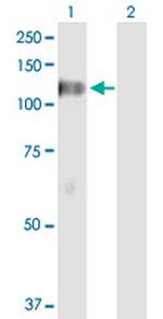 DGKZ Antibody in Western Blot (WB)