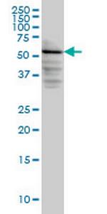 DGKE Antibody in Western Blot (WB)