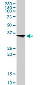 PIR Antibody in Western Blot (WB)