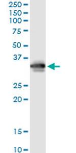 FCN3 Antibody in Immunoprecipitation (IP)