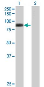 C22orf19 Antibody in Western Blot (WB)