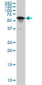 YARS Antibody in Western Blot (WB)