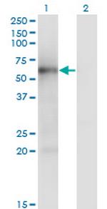 MKNK1 Antibody in Western Blot (WB)