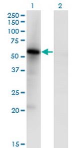 MKNK1 Antibody in Western Blot (WB)