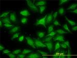 MKNK1 Antibody in Immunocytochemistry (ICC/IF)