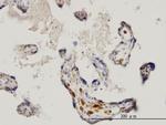 MKNK1 Antibody in Immunohistochemistry (Paraffin) (IHC (P))