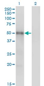 MKNK1 Antibody in Western Blot (WB)