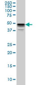 MKNK1 Antibody in Western Blot (WB)