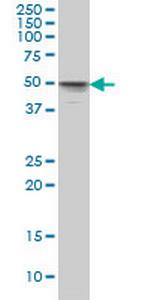 MKNK1 Antibody in Western Blot (WB)