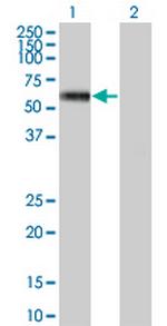 MKNK1 Antibody in Western Blot (WB)