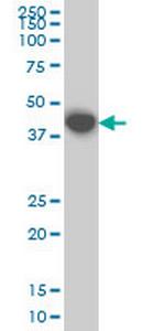 MKNK1 Antibody in Western Blot (WB)