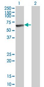 MKNK1 Antibody in Western Blot (WB)