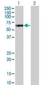 MKNK1 Antibody in Western Blot (WB)