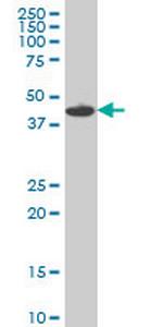 MKNK1 Antibody in Western Blot (WB)