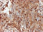 PRKRA Antibody in Immunohistochemistry (Paraffin) (IHC (P))