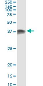 PRKRA Antibody in Immunoprecipitation (IP)