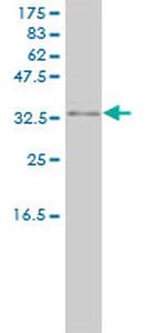 PRKRA Antibody in Western Blot (WB)