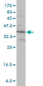 PRKRA Antibody in Western Blot (WB)