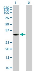 STK16 Antibody in Western Blot (WB)