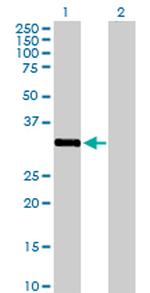 STK16 Antibody in Western Blot (WB)