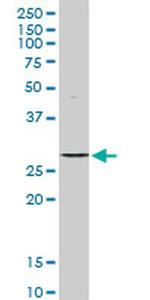 STK16 Antibody in Western Blot (WB)