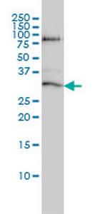 STK16 Antibody in Western Blot (WB)