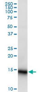 LY6D Antibody in Western Blot (WB)